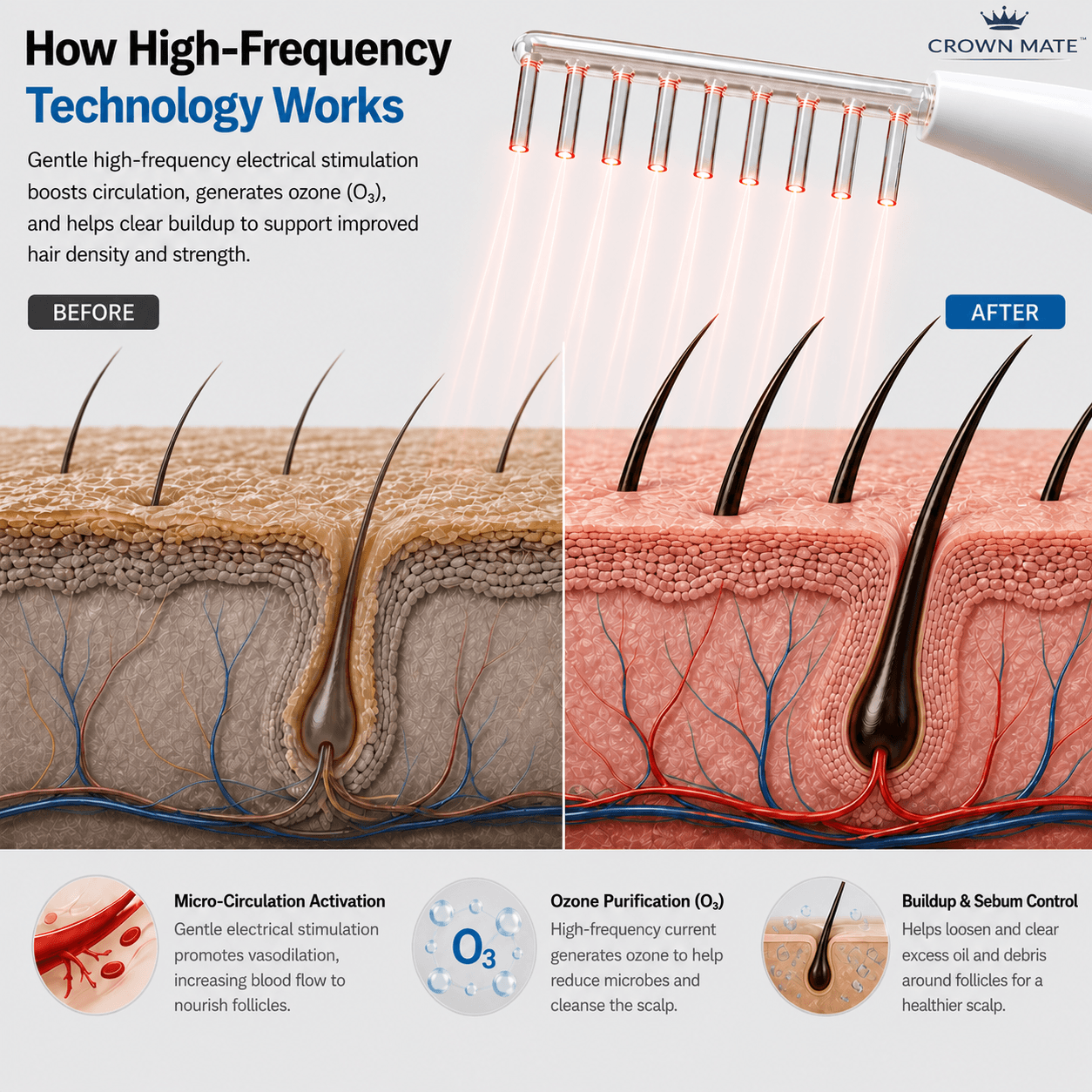 Crownmate High Frequency Wand™